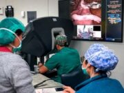 Així funciona el “GPS quirúrgic” que ajuda els metges en cada intervenció
