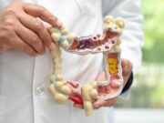 Especialistes destaquen la prevenció del càncer de còlon amb hàbits saludables